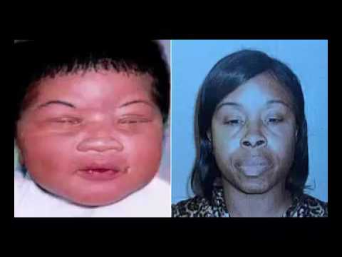 Image result for A girl stolen as a newborn from a hospital in Jacksonville, Florida, has been found alive in South Carolina after more than 18 years, police say. Kamiyah Mobley, who was abducted in July 1998, was found after a tip.