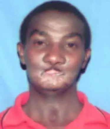 Facial Reconstructive Surgery For Joseph Njoroge