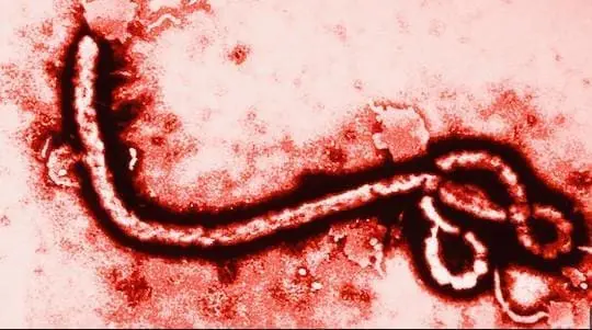 First Person Diagnosed With Ebola in the US has Died