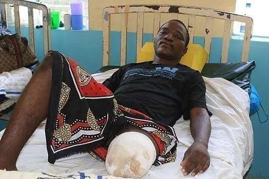 Richard Ooko at the Homa Bay County Referral hospital on July 19, 2016. PHOTO | BENSON MOMANYI