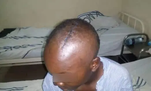 TEEN’S HANDS CHOPPED OFF FOR ‘STEALING’ MIRAA 3 Miraa boy II 1