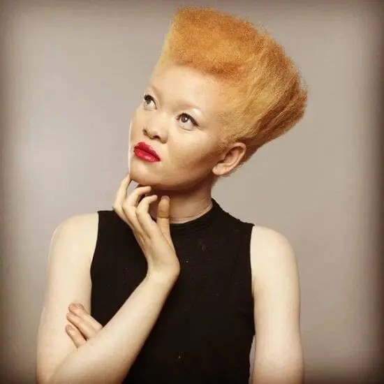 PHOTOS: Kenyan model living with Albinism is redefining beauty 1 PHOTOS: Kenyan model living with Albinism is redefining beauty