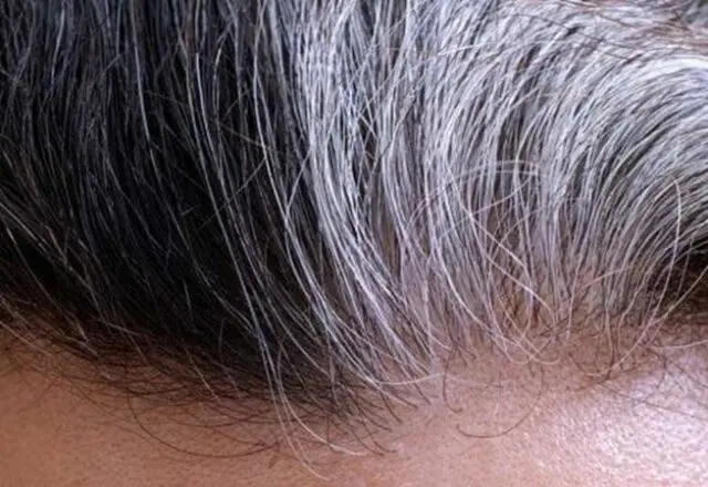 One shade of grey: The white on your head could mean sickness