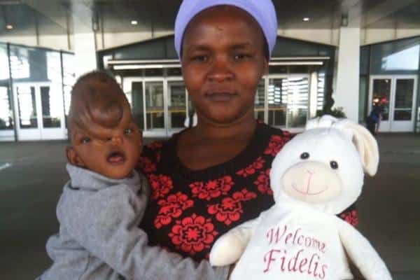 Photos Baby Fidelis Muthoni Lands in Canada for reconstructive surgery