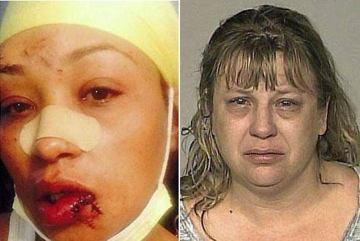 Asma Mohammed Jama after she was assaulted by Burchard Risch (right) in a restaurant in the United States for speaking Swahili. PHOTOS | COURTESY