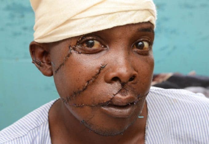 Domestic Violence: Worry As Battered Kenyan Men Suffer In Silence