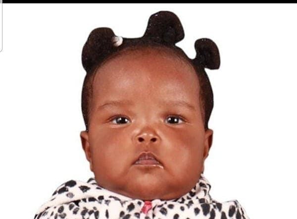 Baby Ariela Mugure Medical Fund Appeal-Urgent Surgery Needed